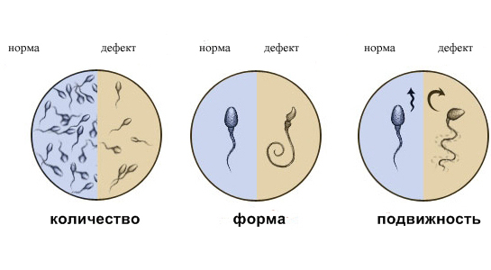Спермограмма (Исследование эякулята) в Москве